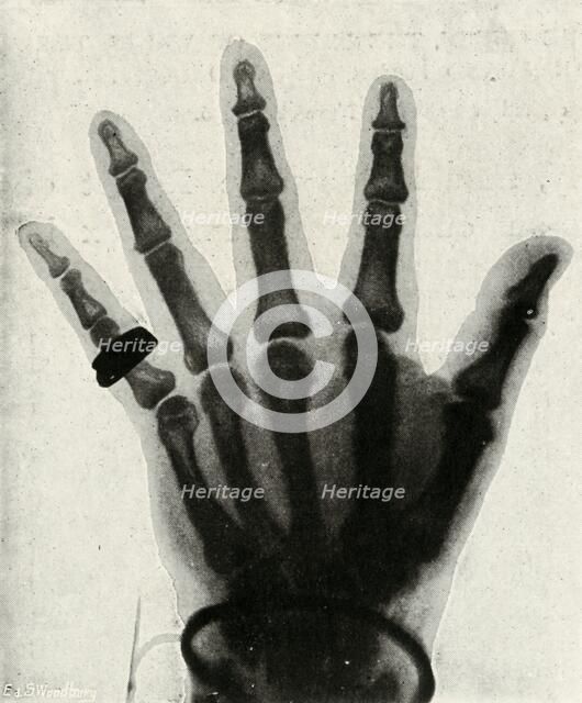 'Radiograph of the Hand of H.R.H. The Prince of Wales', (c1897). Artist: Unknown.