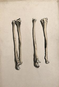 Radius and ulna bones: two figures, 1830-1835. Creator: Unknown