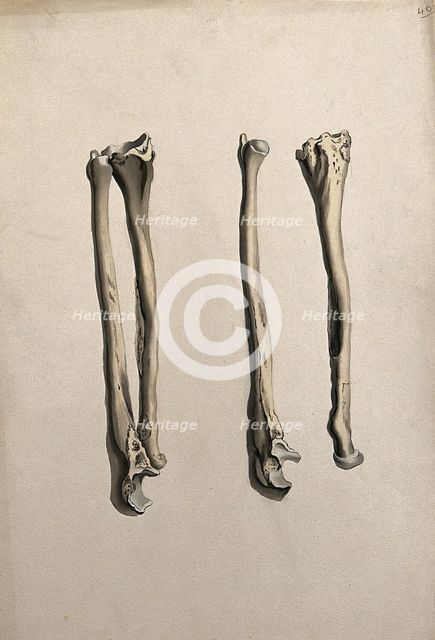Radius and ulna bones: two figures, 1830-1835. Creator: Unknown.