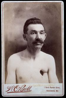 Reverend Eavens, a man with a hole in his chest, between 1800 and 1899. Creator: WC Bell
