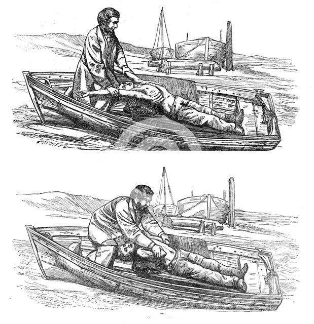 Restorative treatment of the apparently drowned:...Silvester's method of inducing respiration, 1864. Creator: Dalziel Brothers.