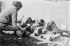 Wounded at Juarez, between c1910 and c1915. Creator: Bain News Service