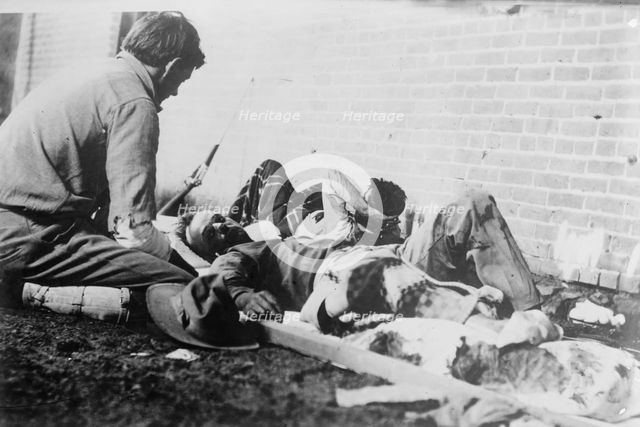 Wounded at Juarez, between c1910 and c1915. Creator: Bain News Service.