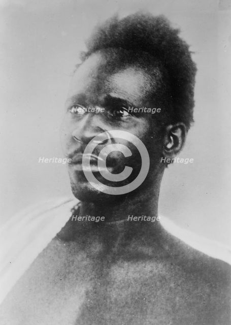 Wounded "French" prisoner of Germans, between c1910 and c1915. Creator: Bain News Service.