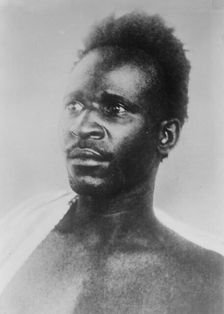 Wounded "French" prisoner of Germans, between c1910 and c1915. Creator: Bain News Service