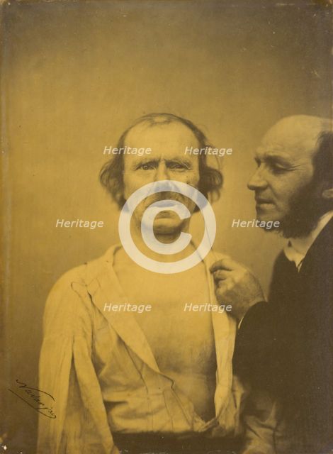 Weeping, tears of pity (left); Relaxed face (right), 1854-1856, printed 1862. Creator: Duchenne de Boulogne.
