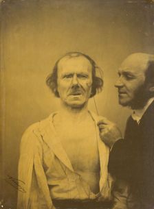 Weeping, tears of pity (left); Relaxed face (right), 1854-1856, printed 1862. Creator: Duchenne de Boulogne