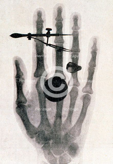 Wilhelm Roentgen's X-ray photograph of his wife's hand, 1896. Artist: Wilhelm Conrad Rontgen