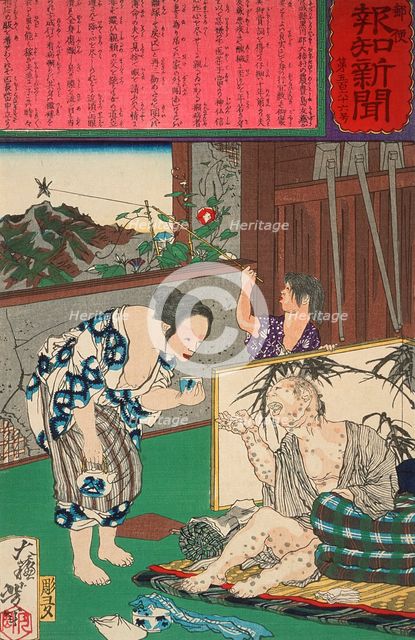 Toshima Tomiyo Who Stayed with Her Leper Husband, Tomozo, 1875. Creator: Tsukioka Yoshitoshi.
