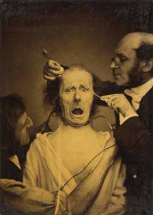 Terror mixed with pain, torture, 1854-1856, printed 1862. Creator: Duchenne de Boulogne
