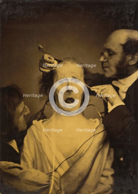 Terror mixed with pain, torture, 1854-1856, printed 1862. Creator: Duchenne de Boulogne.