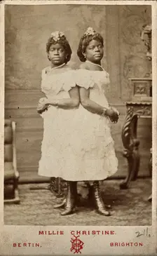 The Millie-Christine sisters, conjoined twins, standing, 1874. Creator: Bertin