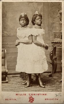 The Millie-Christine sisters, conjoined twins, standing, 1874. Creator: Bertin