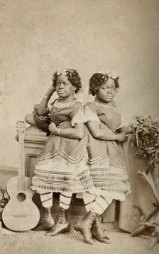 The Millie-Christine sisters, conjoined twins, standing, c1871. Creator: Unknown