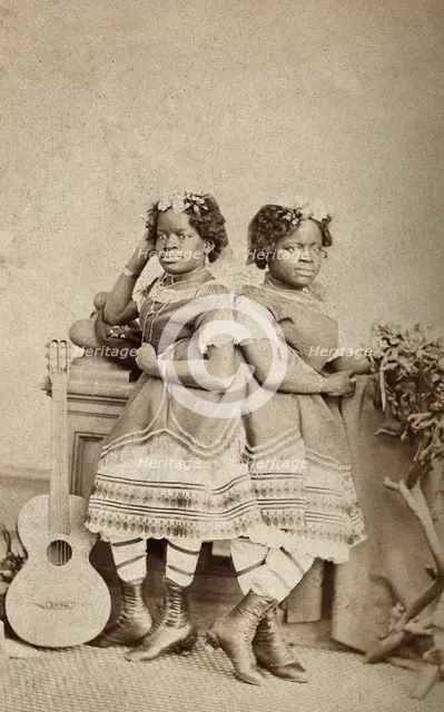 The Millie-Christine sisters, conjoined twins, standing, c1871. Creator: Unknown.