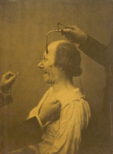 The attention attracted by an object that provokes lascivious ideas and desires, 1854-1856. Creator: Duchenne de Boulogne