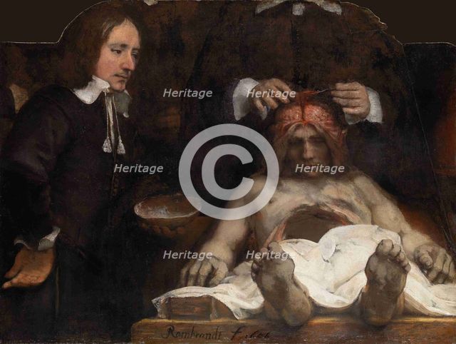 The Anatomy Lesson of Dr. Jan Deijman, 1656. Artist: Rembrandt van Rhijn (1606-1669)