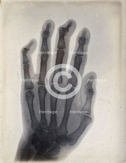 The bones of a hand, viewed through x-ray, 1895.