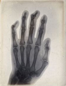 The bones of a hand, viewed through x-ray, 1895