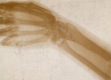 The bones of a hand and wrist, viewed through x-ray, 1896