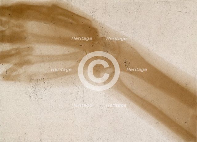 The bones of a hand and wrist, viewed through x-ray, 1896.