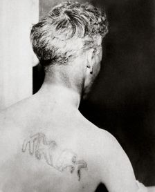 The branded back of Reverend Orrin Van Loon, Detroit, Michigan, USA, July 1924