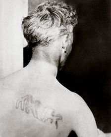 The branded back of Reverend Orrin Van Loon, Detroit, Michigan, USA, July 1924. Creator: Unknown