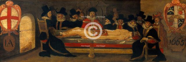 The dissection of a corpse before a company of surgeons, c1665. Creator: Unknown.