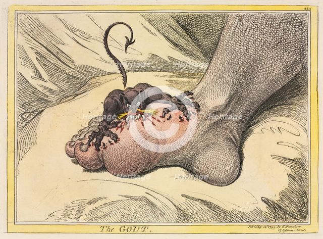 The Gout, 1799. Creator: James Gillray (British, 1757-1815); Hannah Humphrey.