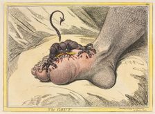 The Gout, 1799. Creator: James Gillray (British, 1757-1815); Hannah Humphrey