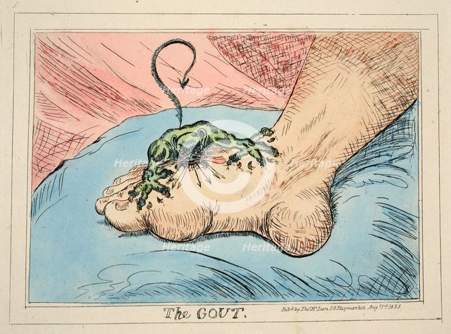 The Gout, 1835.