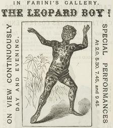 The Leopard Boy! in Farini's Gallery, 1881. Creator: Unknown