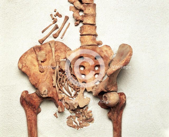 The pelvis of a young Medieval woman. Artist: Unknown