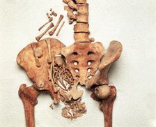 The pelvis of a young Medieval woman