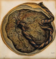 The placenta and umbilical cord, 1800-1860. Creator: John Lizars