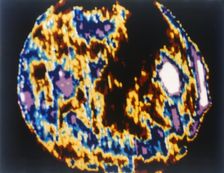 The Sun viewed with the Skylab 3 Apollo Telescope Mount, 1973. Creator: NASA