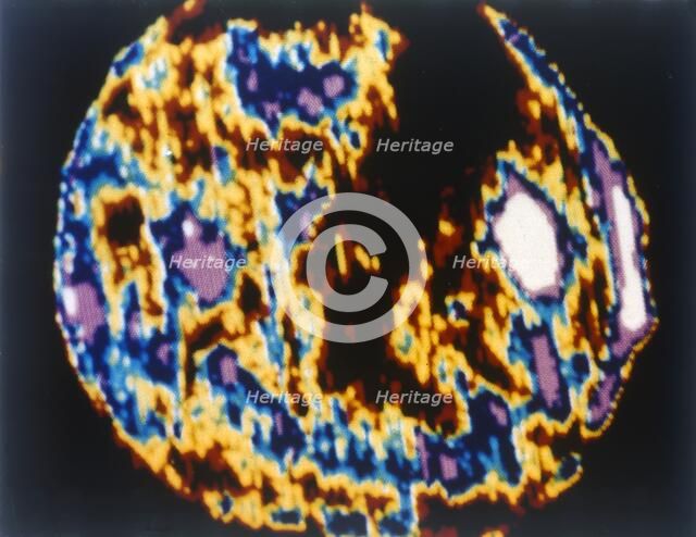 The Sun viewed with the Skylab 3 Apollo Telescope Mount, 1973. Creator: NASA.