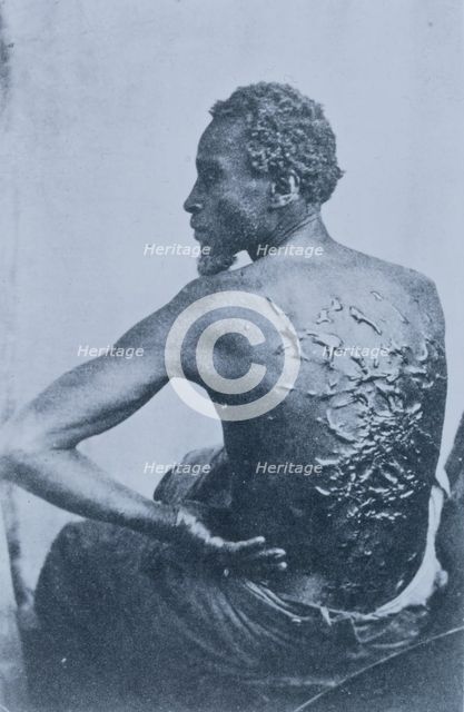 The Scourged Back- The furrowed and scarred back of Gordon, a slave who escaped..., Louisiana, 1863. Creators: Unknown, C. Seaver, Jr..
