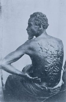 The Scourged Back- The furrowed and scarred back of Gordon, a slave who escaped..., Louisiana, 1863. Creators: Unknown, C. Seaver, Jr.