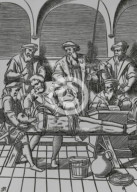 The Water Torture, 1556, (1878).  Creator: Unknown.