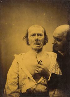 This contraction of m. platysma alone lacks expression, 1854-1856, printed 1862. Creator: Duchenne de Boulogne