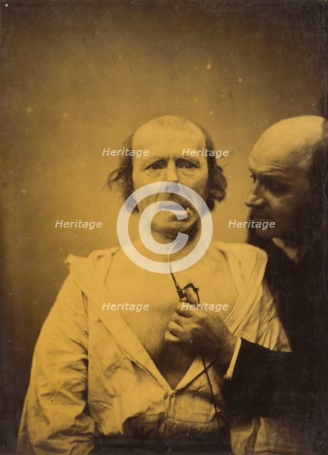 This contraction of m. platysma alone lacks expression, 1854-1856, printed 1862. Creator: Duchenne de Boulogne.