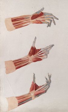 Three dissections of the left hand and wrist, showing the muscles and tendons, (1833?). Creator: Johann Conrad Zeller