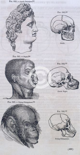 Three faces compared with skulls, 1854. Creator: Unknown.