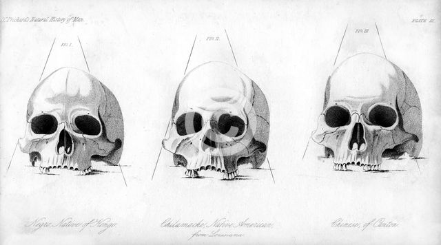 Three types of human skull, 1848. Artist: Unknown
