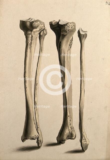 Tibia and fibula bones, 1830-1835. Creator: Unknown.