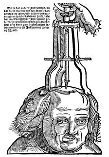 Trephination, 1593. Creator: Unknown
