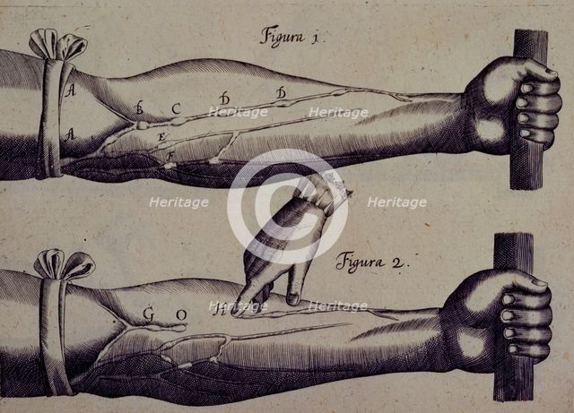 Two arms, and a finger pointing towards a vein, 1628. Creator: Unknown.