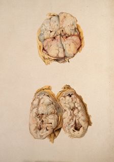 Two diseased parts of the body. Creator: Unknown