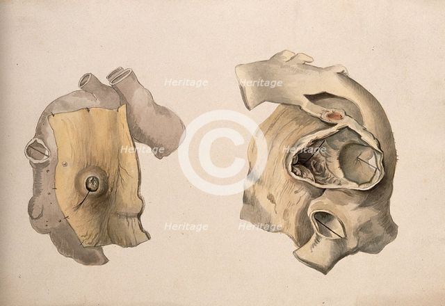 Two diseased parts of the body. Creator: Unknown.